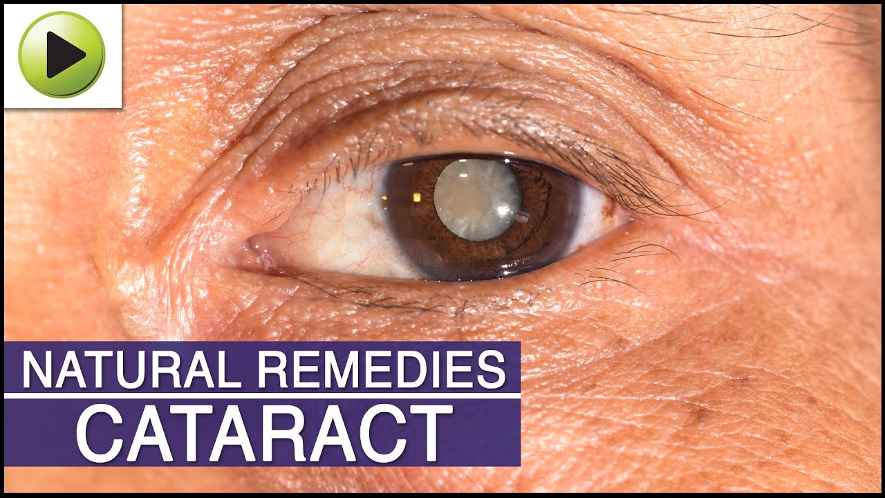 ELIMINATE CATARACTS WITHOUT SURGERY