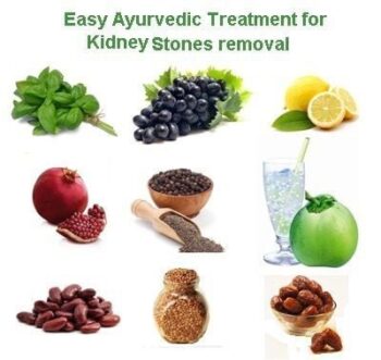 Kidney Stones Treatment in Ayurveda | Cure Kidney Stone