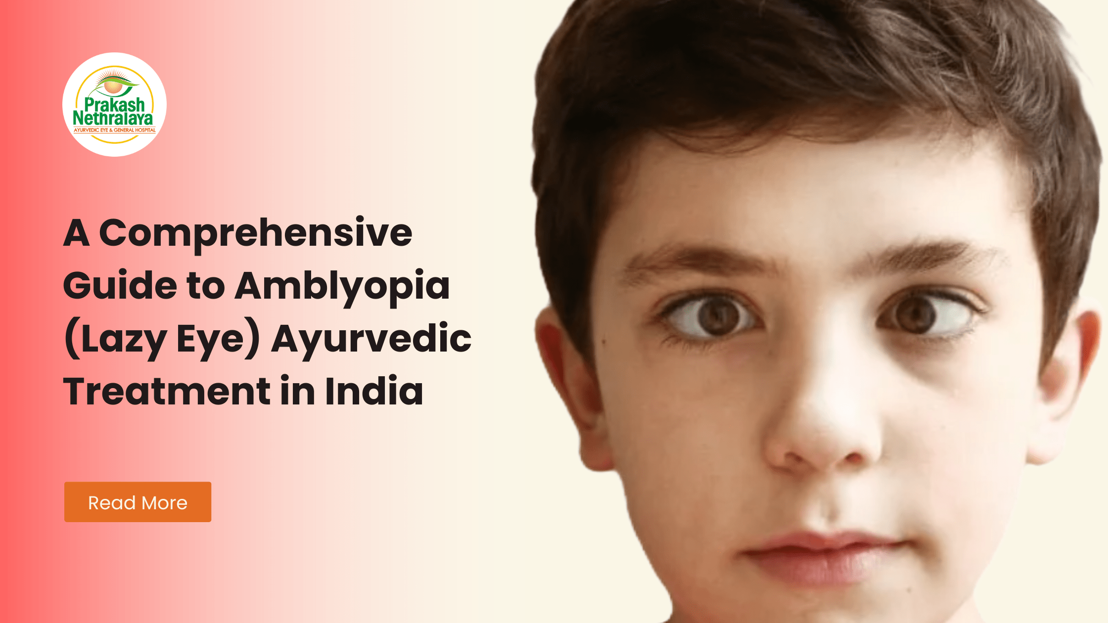 A Comprehensive Guide to Amblyopia (Lazy Eye) Ayurvedic Treatment in ...